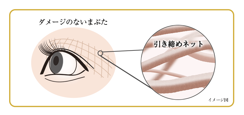 ダメージのないまぶたと引き締めネット